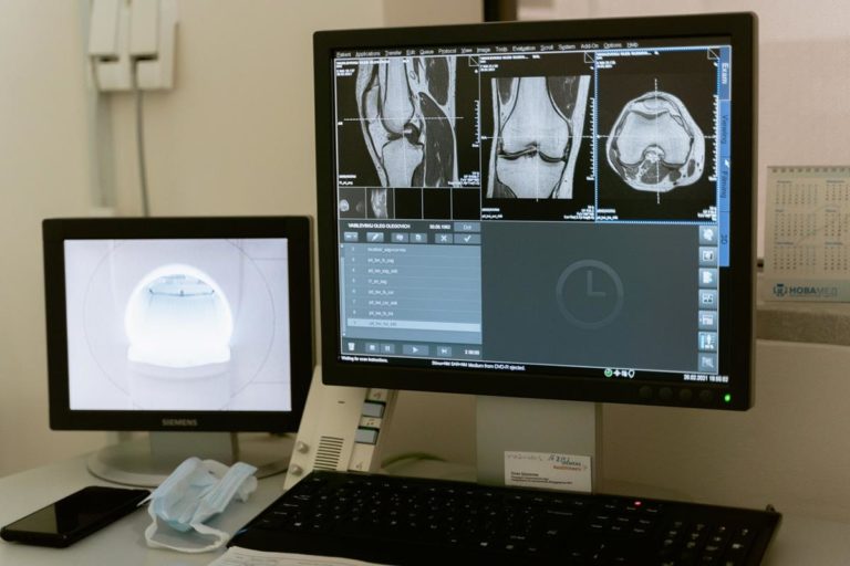 Czy każde dziecko powinno mieć wykonane USG bioderek? Wytyczne i zalecenia lekarzy